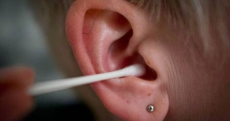 There are many reasons why doctors say you shouldn't stick cotton swabs in your ear. Dandruff Causes, Inside Ear, Sick Kids Hospital, Cleaning Your Ears, Getting Rid Of Dandruff, Ct Scan, Cotton Swabs, Ear Cleaning, Ear Wax