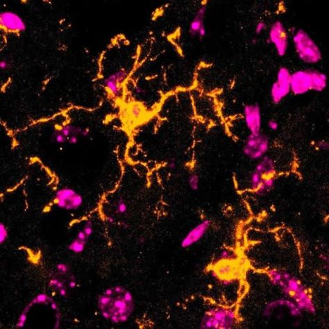 A new study sheds light into the function of microglia and inflammatory response. Confocal Microscopy, Medical Animation, M Image, Science News, Mind's Eye, Disease, Brain, No Response, Medical