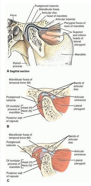 Anatomy of Temporomandibular Joint.....with TMJ Anatomy Video. | Lecture Notes In Dentistry Temporomandibular Anatomy, Tmj Relief Remedies, Tmj Headache, Anatomy Head, Tmj Relief, Joints Anatomy, Dental Anatomy, Jaw Pain, Laser Teeth Whitening