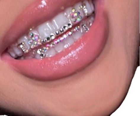 Tooth Gems Black Women, Tooth Gems Ideas Grill, Tooth Gem Gap Teeth, Teeth Gem Business, Tooth Gems Bottom Teeth, Black Women Tooth Gem, Y2k Tooth Gems, Tooth Gem Designs, Tooth Gem Placement