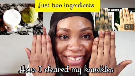 You will see how to get rid of dark knuckles How To Get Rid Of Dark Knuckles, Dark Knuckles, Black Fingers, Sit Back, It Works, Quick Saves, Black