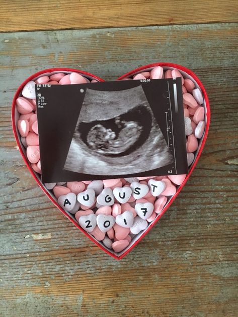 Pregnancy Announcement Valentines Day, Pregnancy Announcement Valentines, Love Heart Candy, Valentines Baby Announcement, Ultrasound Announcement, Valentines Day Hearts Candy, Pregnancy Scan, Valentines Day Sayings, Valentines Pregnancy Announcement