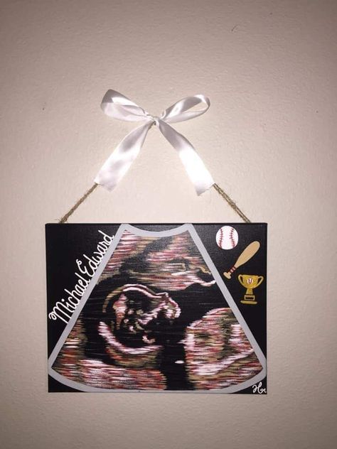 Ultrasound Picture Ideas Display, Ultrasound Picture Ideas, Ultrasound Painting, Boy Nurseries, Baby Ultrasound, Ultrasound Pictures, Nursery Paintings, Canvas Painting Diy, Photo Scrapbook