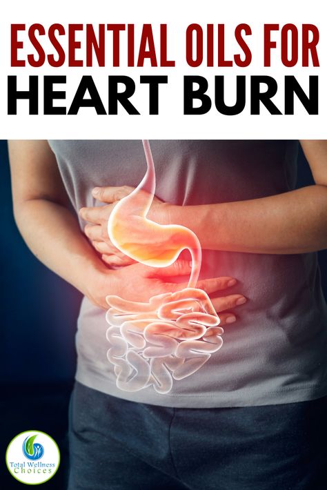 Heart Burn Relief, Preparing For Labor, Essential Oil Spray Recipes, Burn Relief, Heart Burn, Growing Healthy Hair, Heart Burn Remedy, Pregnancy Help, Natural Pregnancy