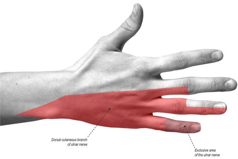 Ulnar nerve anatomy, innervation, injury, damage, palsy & entrapment Nerve Injury, Cubital Tunnel Syndrome, Nerve Conduction Study, Nerve Anatomy, Radial Nerve, Ulnar Nerve, Pinched Nerve, Biology Facts, Human Body Anatomy