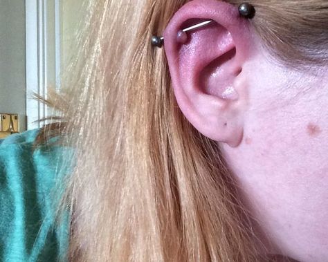 Cartilage Piercing Bumps: Scars, Keloids & Infection | AuthorityTattoo Keloids Ear Piercing, Cartilage Piercing Infection, Piercing Alla Lingua, Infected Ear Piercing, Cartilage Piercing Care, Piercing Bump, Tattoo Over Scar, Ear Peircings, Piercings Cartilage