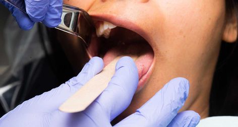 Dental Crown Procedure, Dental Anesthesia, Local Anesthesia, Family Dental Care, Tooth Removal, Dental Bridge, Dental Crowns, Dental Cleaning, Dental Procedures