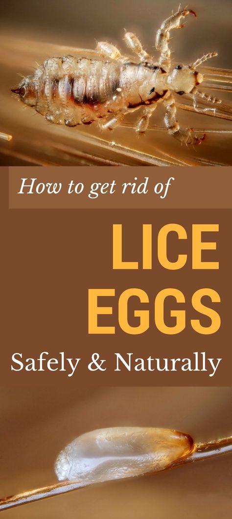 Homemade Shower Cleaner, Lice Eggs, Cleaner Recipes, Mattress Cleaning, Car Cleaning Hacks, Kitchen Cleaning Hacks, Oven Cleaning, Grout Cleaner, Cleaners Homemade