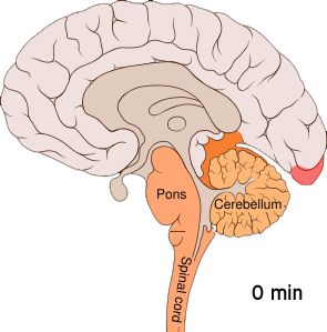 aura Migraine Aura, Human Nervous System, Spinal Muscular Atrophy, Peripheral Nervous System, Motor Neuron, Cerebral Cortex, Facial Nerve, Brain Stem, Cranial Nerves