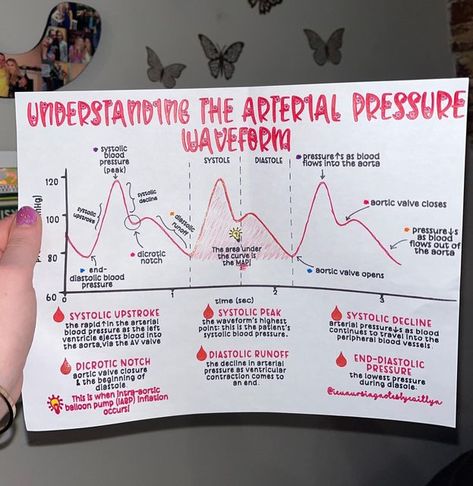 Arterial Line Nursing, Hemodynamics Nursing, Radial Artery, Arterial System, Respiratory Therapy Notes, Cardiac Cath Lab, Cath Lab Nursing, Arterial Line, Nursing School Organization