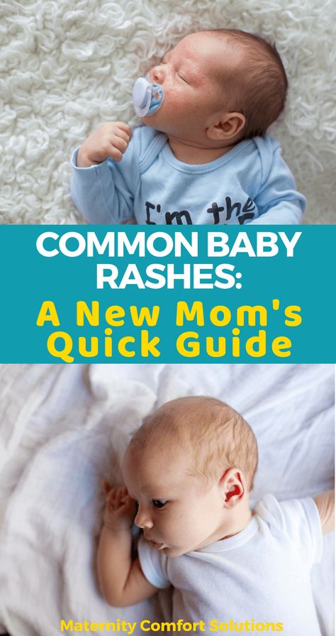 11 Common Baby Rashes: A Mom’s Quick Guide via @MaternityComfortSolutions Newborn Rash, Baby Rashes, Cake Children, Face Cake, Newborn Hacks, Baby Sleep Problems, Baby Care Tips, Baby Prep, Before Baby