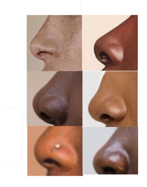 Good for reference practices Fingers Pressed Together Reference, Nose Study Reference Photo, Different Kinds Of Noses, Different Noses Reference, Noses Reference Photo, Nose Practice Drawing, Art Reference Images, Mouth Study Reference, Removing Shirt Pose Reference