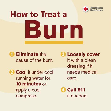 How to Treat a Burn Burn First Aid, First Aid For Burns, Burn Relief, American Red Cross, Emergency Kit, Red Cross, First Aid, Medical, How To Apply