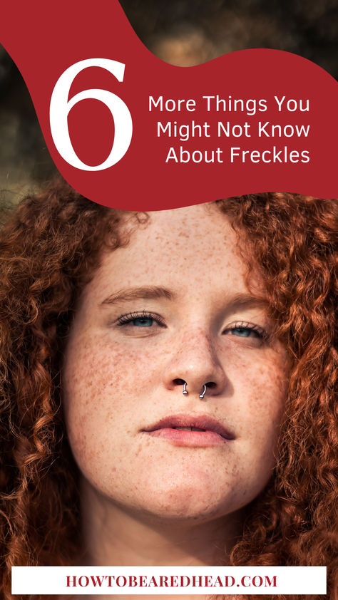 Many redheads carry the freckle gene, and having freckles is a common redhead trait, although not all redheads have freckles, and not all people with freckles also carry the redhead gene. Here are a few more things you might not know: Red Hair Gene, Freckle Pattern, Blonde Hair Freckles, Blonde With Freckles, People With Freckles, Red Hair Freckles, Freckles Makeup, Shades Of Blonde, Whats Good