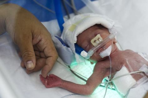 Scientists Didn’t Stop Their Study Of Premature Babies Even After Finding Out That It Depended On Broken Oxygen Meters Injection Hand Pic, Premature Baby, Public Records, What Is Life About, Infants, Scientists, Baby Photography, American History, Health