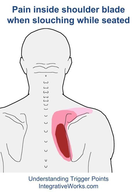 Shoulder Muscle Pain, Punkty Spustowe, Shoulder Stretches, Forward Head Posture, Back Stretches For Pain, Shoulder Pain Relief, Trigger Point Therapy, Upper Back Pain, Neck And Shoulder Pain