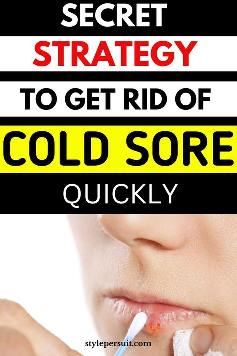 25 Ways To Get Rid Of A Cold Overnight How To Get Rid Of A Cold Sore Overnight, How To Heal Cold Sores Fast, Best Cold Sore Remedy Overnight, Remedies For Cold Sore, How To Heal A Cold Sore Fast, Natural Remedies For Cold Sores, Cold Sores Remedies Overnight, Diy Cold Sore Remedy Fast, How To Get Rid Of A Cold Sore Fast