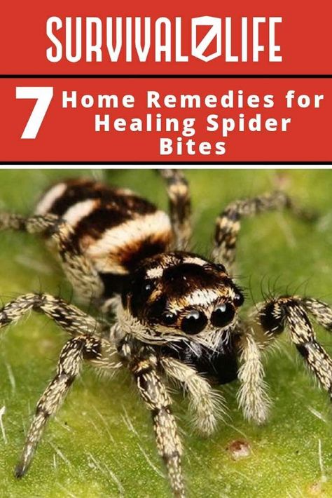 🕷🕸⛑ The symptoms of spider bites may be visible as soon as possible, to several days or even weeks. 😲 You will want to avoid getting bitten by a spider at all costs since it may spell doom if it’s the deadlier kind. 👍🏼 Thus, here are 7 tips on how to treat spider bites at home. #spider #spiderbites #outdoorskills #outdoors #bushcraft #survivaltips #survivalskills #survivalkit Treating Spider Bites, Spider Bite Symptoms, Spider Repellant, Recluse Spider Bite, Hobo Spider, Home Remedies For Spiders, Homemade Lotions, Spider Bite, House Spider