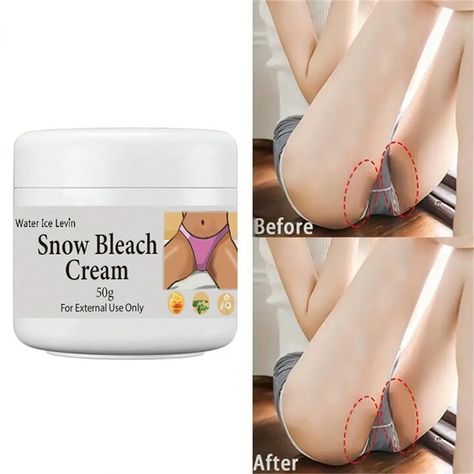 Body Whitening Cream For Brightening & Moisturizing Skin, Intimate Bleaching Cream For Sensitive Areas | SHEIN USA Skin Care Home Remedies, Bleaching Cream, Whitening Soap, Dry Skin Body, Natural Face Skin Care, Body Gel, Whitening Cream, Skin Repair, Perfect Skin Care Routine