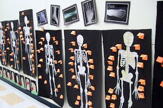 Bone Project, Skeletal System Project, Skeletal System Activities, Sport Medicine, The Skeletal System, 3rd Grade Science, System Unit, Science Camp, Human Body Unit