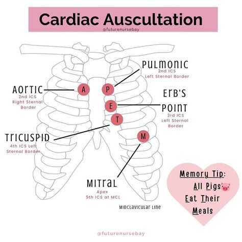 Auscultation Points, Cardiac Assessment, Nursing School Organization, Cardiac Sonography, Paramedic School, How To Remember, Nursing School Motivation, Nurse Study Notes, Nursing Student Tips