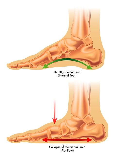 Flat Feet Exercises, Ankle Exercises, Exercise Coach, Foot Anatomy, Foot Exercises, Flat Foot, Yoga Anatomy, Mary Jane Platform Shoes, Posture Exercises