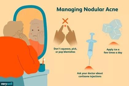 Nodule Acne, Pimple Under The Skin, Nodular Acne, Inflamed Pimple, Painful Pimple, Back Acne Remedies, Blind Pimple, How To Help Nausea, Pimples Under The Skin