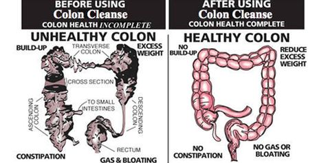 amcc colon comparison Cleanse Colon, Colon Cleanse Diet, Healthy Colon, Clean Colon, Colon Cleanse Recipe, Colon Cleansing, Full Body Detox, Colon Health, Natural Detox Drinks