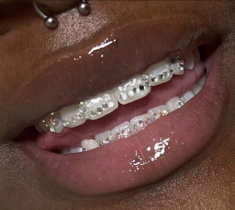 Pretty Teeth, Dental Jewelry, Grillz Teeth, Teeth Caps, Diamond Teeth, Tooth Gems, Grills Teeth, Amazon Jewelry, Teeth Braces