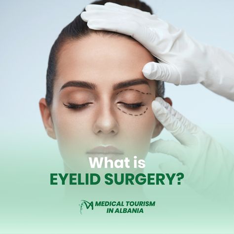 Improve Your Appearance, Eye Surgery, Medical Tourism, Your Eyes, Surgery, Eye Makeup, Medical, Health, Makeup