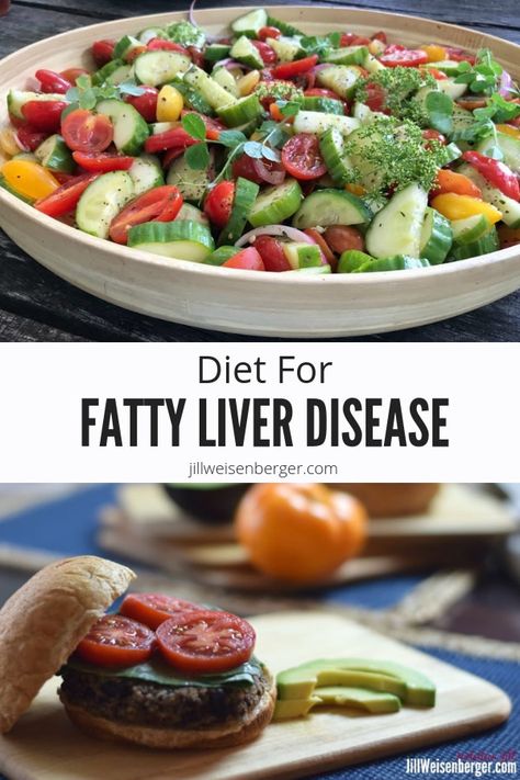 Liver Diet Recipes, Liver Detox Recipes, Healthy Liver Diet, Liver Recipes, Liver Diet, Low Carb Diet Plan, Best Diet, Liver Detox, Healthy Liver