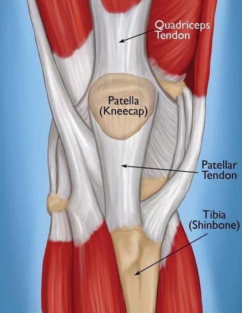 Have you ever felt that annoying pain in the front of your knee that just doesn’t seem to go away? Your Ultimate Guide to Jumper's knee https://strivept.ca/2020/01/24/jumpers-knee-your-ultimate-guide/ Runners Knee Pain, Patellar Tendon, Jumpers Knee, Patellofemoral Pain Syndrome, Swollen Knee, Straight Leg Raise, Anterior Cruciate Ligament, Runners Knee, Knee Pain Exercises