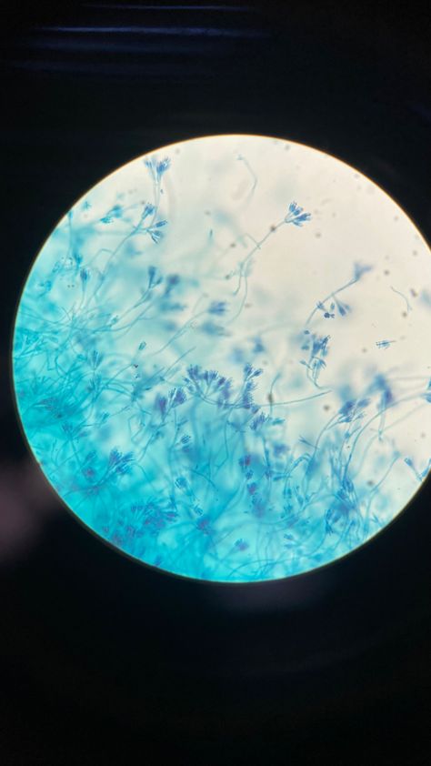 Microbiology Under Microscope, Under The Microscope, Microbiology, Health Science, Science, Health, Quick Saves