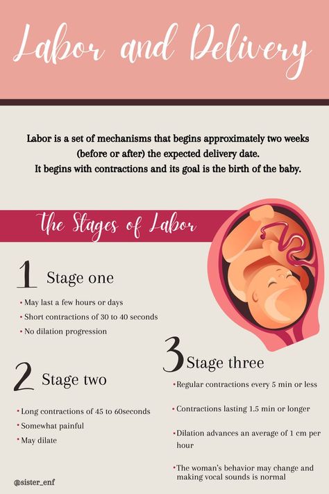 Labor Doula, Tips Study, Stages Of Labor, Labor Delivery, Labor And Delivery, I Hope You, Labor, I Hope