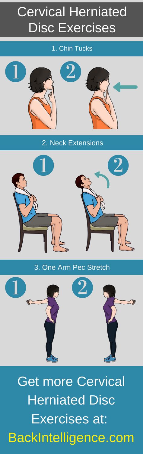 A herniated cervical disc occurs when one of the discs in the neck protrudes on a nearby nerve and causes pain. In this article we’ll discuss this condition and give you specific exercises that you can do at home to alleviate your pain. Check it out on our website! Cervical Pain Exercises, Cervical Disc, Forward Head Posture Exercises, Cervical Pain, Cervical Spondylosis, Neck And Shoulder Muscles, Bulging Disc, Back Stretches For Pain, Neck Exercises