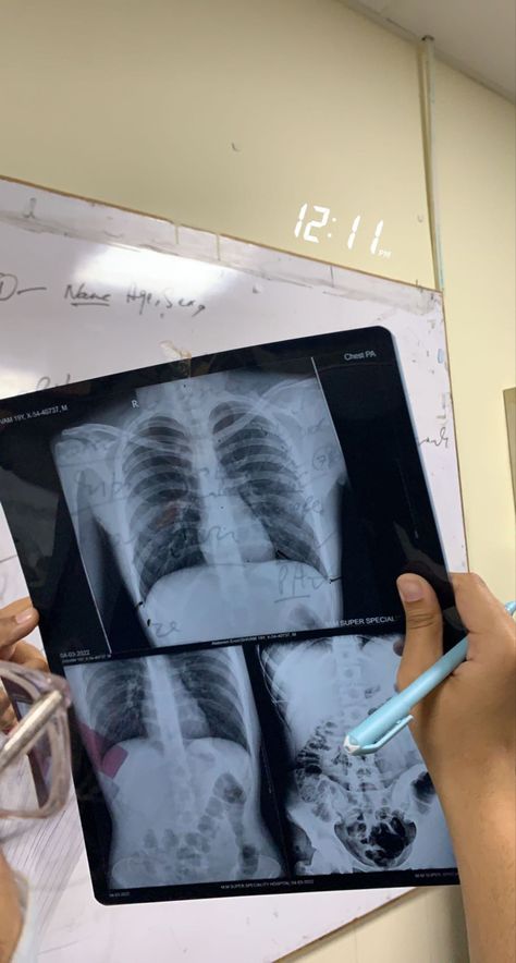 Radiologist Tech Aesthetic, X-ray Tech, X Ray Technician Aesthetic, Xray Tech Aesthetic, X Ray Tech Student, Rad Tech Aesthetic, Radiography Aesthetic, Radiology Student Aesthetic, Radiologist Aesthetic