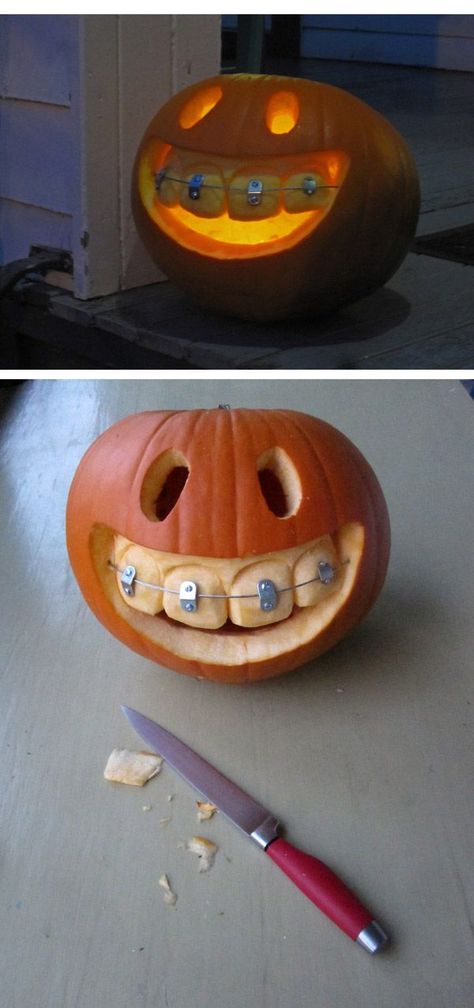 (image) PUMPKIN Jack-o-lantern with Braces ~ fairly easy but an adorably fun design! Would be perfect for those with braces or for use at your dentist or orthodontist office. HINT: use soda can TABS with metal wire to create the braces. Cool Pumpkin Carving Ideas, Cool Pumpkin Carving, Amazing Pumpkin Carving, Carving Pumpkins, Pumpkin Carving Ideas, Halloween Templates, Fall Festivities, Pumpkin Jack, Pumpkin Season