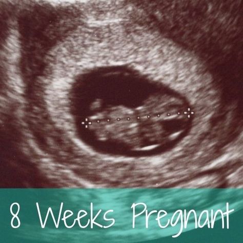 8 Weeks Pregnant Ultrasound, 8 Week Ultrasound, 8 Weeks Pregnant, Pregnant Ultrasound, Weekly Pregnancy, Ultrasound Pictures, Be Quiet, Weeks Pregnant, The Hollow