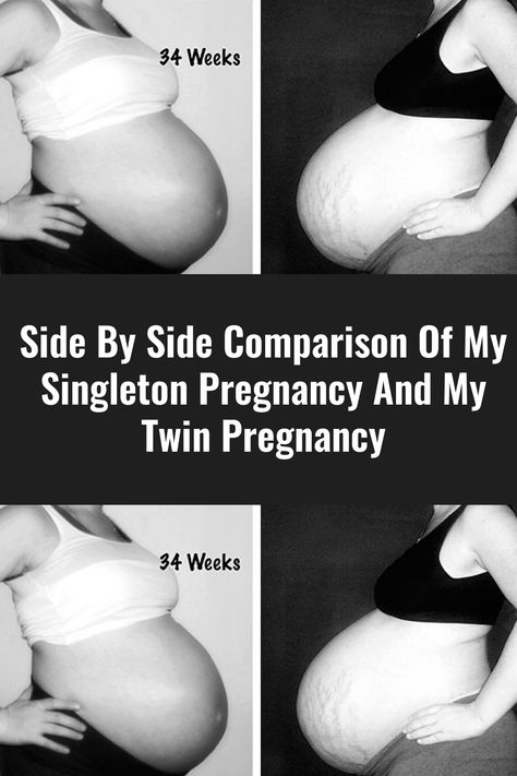 Side By Side Comparison Of My Singleton Pregnancy And My Twin Pregnancy Twins Pregnancy Belly, Twin Belly, Twin Pregnancy Belly, Types Of Twins, Twin Tattoos, Parent Tattoos, Pregnancy Belly, Polycystic Ovarian Syndrome, Parents Quotes Funny