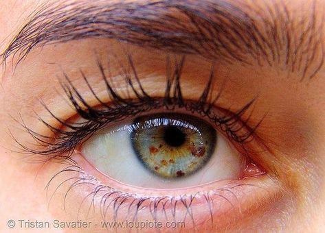 Partial Heterochromia, Eye Freckles, Eye Iris, Iris Eye, Pinterest Uk, Colored Eye Contacts, Realistic Eye Drawing, Beautiful Eyes Color, Rank 1