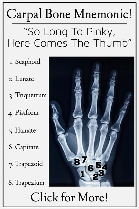 Bone Memorization, Hand Xray Anatomy, Bones Of The Hand And Wrist, Anatomy Easy Learning, Anatomy And Physiology Mnemonics, Carpal Bones Anatomy, Bones Names Anatomy, Wrist And Hand Anatomy, Carpal Bones Mnemonic