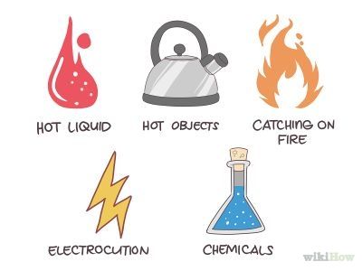 How to Know What Degree a Burn Is -- via wikiHow.com Second Degree Burn, Types Of Burns, 2nd Degree Burns, Burn Care, Advanced Cardiac Life Support, Degree Burns, Family Nurse Practitioner, Critical Care Nursing, Master Of Science