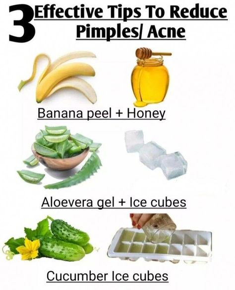 Acne Diy Face Mask, Overnight Pimple Remedies, Get Rid Of Pimples Overnight, Rid Of Pimples Overnight, Back Acne Remedies, How To Clear Pimples, Home Remedies For Pimples, Get Rid Of Pimples, Rid Of Pimples