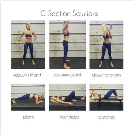 C-SECTION SOLUTIONS: HOW TO ELIMINATE THE POOCH AND REDUCE THE “TUMMY SHELF” C Section Shelf, After C Section Workout, C Section Workout, Post C Section, Stomach Toning, Postpartum Exercises, Heidi Powell, Stomach Toning Workouts, Pooch Workout