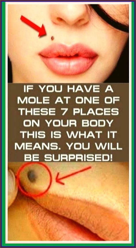 IF YOU HAVE A MOLE AT ONE OF THESE 7 PLACES ON YOUR BODY THIS IS WHAT IT MEANS. YOU WILL BE SURPRISED Mole Meaning, Women Health Care, School Communication, Health Planner, Health Facts, Natural Treatments, Diet Tips, Mole, Womens Health