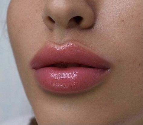 Pretty Full Lips, Russian Lips Filler Before And After, Russian Lips Filler, Russian Lip Filler, Lip Filler Inspiration, Lip Fillers Juvederm, Russian Lips, Dermal Fillers Lips, Lips Inspiration