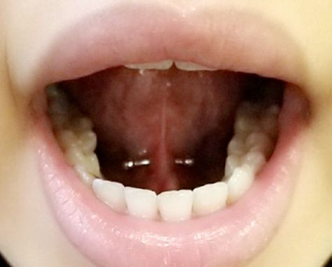 Frenulum Tongue Piercing, Under Tounge Piercing, Tounge Piercings Aesthetic, Under Tongue Piercing, Tongue Piercing Aesthetic, Unusual Piercings, Frenulum Piercing, Piercing Aesthetic, Vintage Fashion Sketches