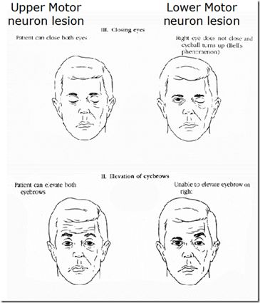 Upper Motor Neuron, Speech Language Pathology Grad School, Internal Capsule, Medical Slp, Motor Neuron, Cerebral Cortex, Facial Nerve, Slp Activities, Oral Motor