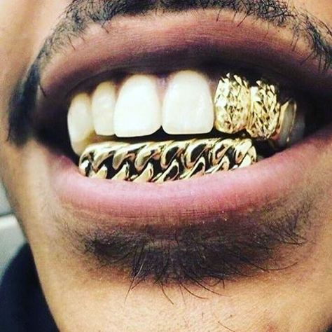 Thugga King Killmonger, Gold Slugs, Gold Teeth Grills, Gold Tooth, Grillz Teeth, Diamond Grillz, Gold Grill, Diamond Teeth, Gold Grillz