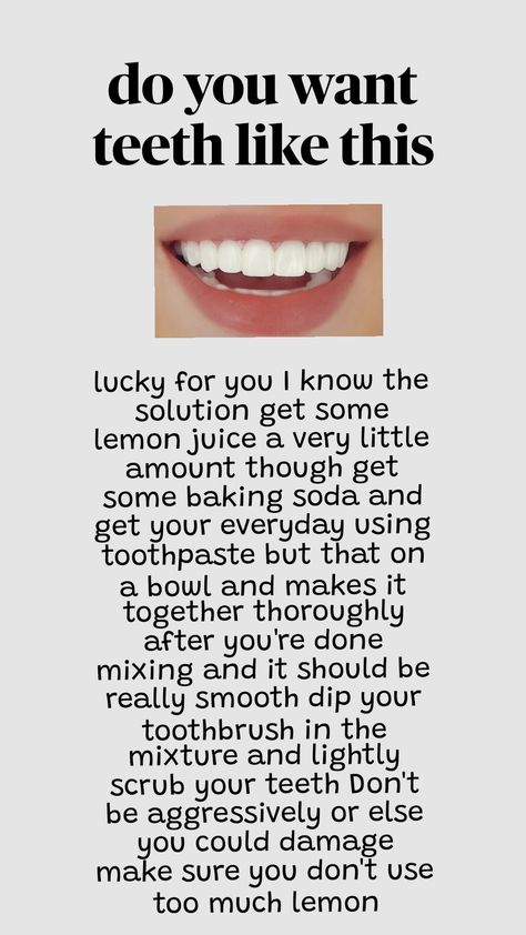 how to get beautiful white teeth #beauty How To Get White Teeth Overnight, How To Have Straight Teeth, How To Get Straight Teeth, How To Smile Without Showing Teeth, Straight White Teeth, White Teeth Tips, Teeth Tips, Teeth Aesthetic, Fix Teeth